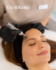 Máy phi kim chuyên nghiệp thẩm mỹ cao cấp Exoblanc Derma Pen