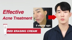 Kem Dưỡng Trắng Trị Thâm Mụn Liền Sẹo Medicube Red Erasing Cream 100ml