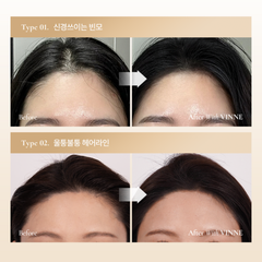 Phấn che khuyết điểm tóc thuần chay giúp che phủ tóc hói và phủ nhuộm tóc bạc VINNE All Cover Perfect Hair Cushion Stick 5,1g
