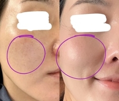 Phấn nước che chủ mịn màng siêu bám dính da trang điểm tự nhiên SkanSkin af Della 15g