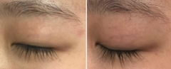 Tinh chất dưỡng dài lông mi và lông mày LaForLab Longcil Essence Long Eyelash Conditioning Essence