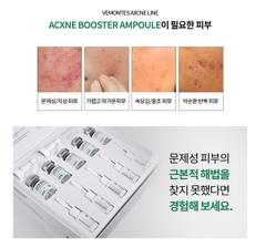 Tinh chất hỗ trợ điều trị mụn VEMONTES AXCNE Booster Ampoule Kit Agent 1 Agent 2 3ml