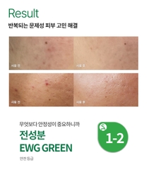 Tinh chất hỗ trợ điều trị mụn VEMONTES AXCNE Booster Ampoule Kit Agent 1 Agent 2 3ml