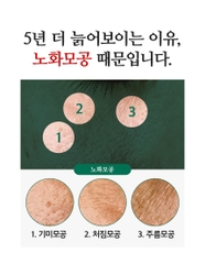 Tinh chất rong nho se khít lỗ chân lông và kiểm soát dầu bã nhờn MommyCare Sea Grapes Pore Lifting Ampoule 50ml (sản phẩm được bán tại phòng khám da liễu)