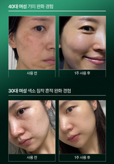 Tinh chất se Tế bào gốc cá hồi cải thiện chăm sóc se khít lỗ chân lông và làm trắng và tăng độ đàn hồi da OAZO PDRN 3D Boosting Ampoule 30ml