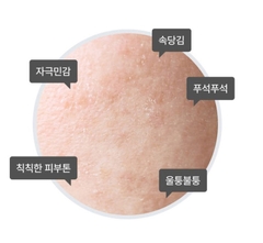 Tinh Chất trẻ hóa da làm dịu da Chiết Xuất Quả Nhàu thế hệ thứ 2 Celimax 2nd Generation Noni Ampoule Calming & Radiance 30ml