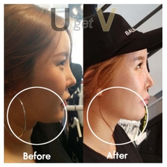 Kem Dưỡng Chống Nhăn Nâng Cơ Mặt UgetV Cream 40ml