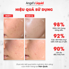 KEM LÀM TRẮNG, KIỂM SOÁT DẦU & THU NHỎ LỖ CHÂN LÔNG ANGEL'S LIQUID GLUTATHIONE PLUS NIACINAMIDE CICA CREAM 50ML