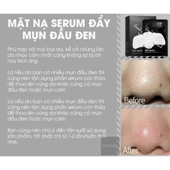 Hộp 20 miếng Mặt Nạ Đẩy Mụn Đầu Đen Ciracle Goodbye Blackhead