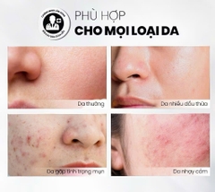 Tẩy Tế Bào Chết Home Peel Căng Bóng, Cấp Ẩm Và Làm Sáng Da MD Care Mande Exfo 30ml