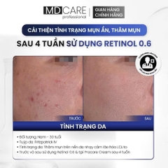 Kem Dưỡng Làm Sáng, Trẻ Hoá Và Cải Thiện Nếp Nhăn MD CARE PRO-RETINOL 30ml