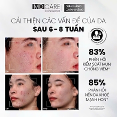 Sữa Rửa Mặt BHA Dạng Bọt MD CARE Dành Cho Da Dầu Mụn Nhạy Cảm 150ml