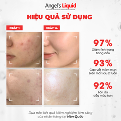 NƯỚC THẦN LÀM TRẮNG, KIỂM SOÁT DẦU & THU NHỎ LỖ CHÂN LÔNG ANGEL'S LIQUID GLUTATHIONE PLUS NIACINAMIDE CICA CREAM 150ML