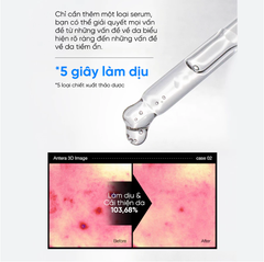 Tinh Chất Giảm Mụn Mờ Thâm Phục Hồi Da Mụn Feld Apotheke Phyto Calm Serum 30ml