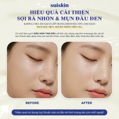 Sáp tẩy trang Suiskin Blooming Canola Cleansing Balm 90ml