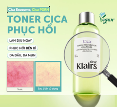 Nước hoa hồng Dear Klairs Supple Preparation Cica Toner 180ml