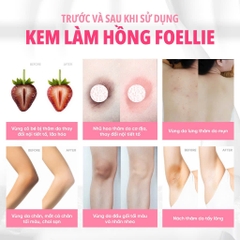 Kem Làm Hồng Nhũ Hoa Foellie, Giảm Thâm Vùng Kín Cao Cấp Hàn Quốc Foellie 30ml