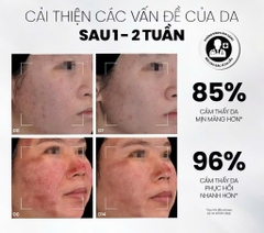 Serum Chống Lão Hóa, Kích Thích Tăng Sinh Collagen, Làm Đầy Sẹo MD CARE Copper Peptide Serum 30ml