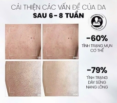 Sữa Tắm Giảm Mụn & Tẩy Tế Bào Chết AHAs & BHA MD CARE Exfoliating Body Wash 200ml