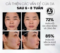 Tẩy Tế Bào Chết Home Peel Làm Sáng, Mờ Thâm Và Đều Màu Da MD Care Glow Exfo 30ml
