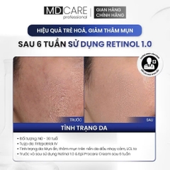 Kem Dưỡng Làm Sáng, Trẻ Hoá Và Cải Thiện Nếp Nhăn MD CARE PRO-RETINOL 30ml