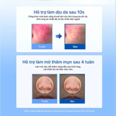 Kem dưỡng ẩm, hỗ trợ tái tạo da Midnight Blue Clearing Water Cream 50g