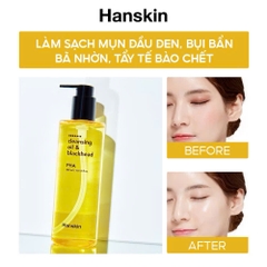 Dầu Tẩy Trang Cho Da Nhạy Cảm HANSKIN PORE CLEANSING OIL PHA 300ml