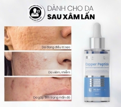 Serum Chống Lão Hóa, Kích Thích Tăng Sinh Collagen, Làm Đầy Sẹo MD CARE Copper Peptide Serum 30ml