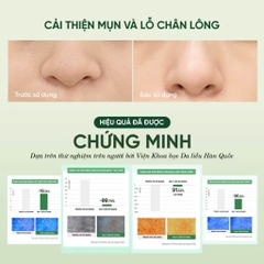 Mặt Nạ Rửa Mặt 2 In 1 Làm Sạch Sâu Cho Da Dầu Mụn Nhạy Cảm Dewdap Cicatea Pore & Sebum Pack Cleanser 150ml