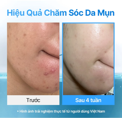 Tinh chất Dear Klairs EGF Hyaluronic Acid cấp ẩm, làm dịu, phục hồi da EGF Blue AC Calming Serum 50g