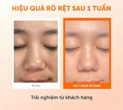 (Tặng toner Klairs mini 30ml tím) Dear, Klairs Nước hoa hồng hỗ trợ làm sáng da Freshly Juiced Vitamin Essence Toner 180ml