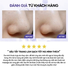 Dầu tẩy trang BHA/LHA làm sạch sợi bã nhờn và mụn đầu đen Frankly Deep Cleansing Oil 200ml
