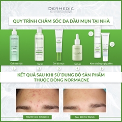 Chấm mụn Dermedic NORMACNE Therapy H2O2 acne spot treatment 15ml