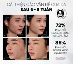 Sữa Rửa Mặt MD CARE Hydrating Milk Cleanser  Dịu Nhẹ Và Cấp Ẩm Cho Da Nhạy Cảm200ml