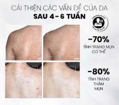 Xịt Tẩy Tế Bào Chết Toàn Thân AHAs & BHA MD CARE Exfoliating Body Spray 100ml