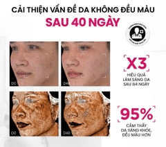 Serum Sáng Da Đa Tầng Và Toàn Diện Thế Hệ Mới MD CARE Brightenyl Serum 30ml