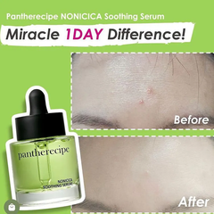 Tinh chất PESTLO Pantherecipe Nonicica Soothing Serum 30ml