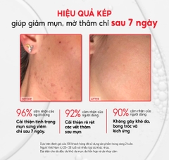 Tinh Chất Giảm Mụn, Mờ Thâm, Làm Sạch Tế Bào Chết 12% PHA + 4,75% Tiam AC Fighting PHA 12 Purifying Liquid