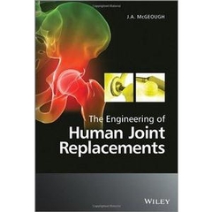 The Engineering of Human Joint Replacements