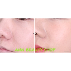 Tinh Chất Red Peel Tingle Serum Sonatural 35ml