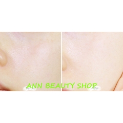 Gel Rau Má Centella CiCa Soothing Gel BRTC 150ML