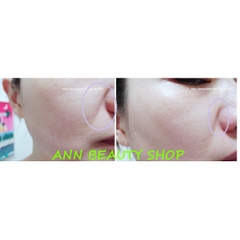 KEM MẮT Beauty Bakery Haute Cuisine Premium Snail Eye Cream 30gr