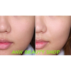 Kem dưỡng chuyên sâu HANYUL Seo Ri Tae Skin Refining Intensive Balm
