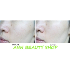 THANH LÝ Kem dưỡng trắng da Ôc Sên It's skin minisize 10ml (DATE 6/2021)