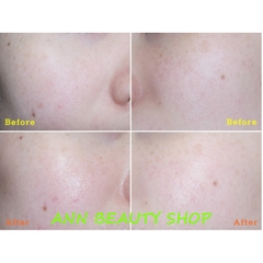 KEM DƯỠNG BEAUTY BAKERY CHEONG EUN RO RENATURATION CREAM 21ML