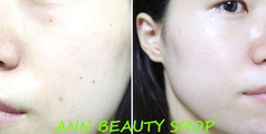 Kem Dưỡng Da Nhạy Cảm CELL FUSION C Post α Calming Down Cream 15ml (DATE 4/2022)