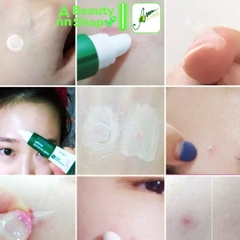 Gel Dán Mụn Second Skin Patch 10ML (date 9/2022)