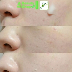 Gel tẩy da chết Missha Super Aqua 10 Hyaluronic Acid Ultra Hyalron Peeling Gel 100ml (bản 2020)