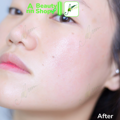 Kem dưỡng ẩm HANYUL Pure Artemisia Calming Water Cream
