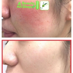 Kem Dưỡng Ốc Sên Phục Hồi Da Some By Mi Snail Truecica 60g